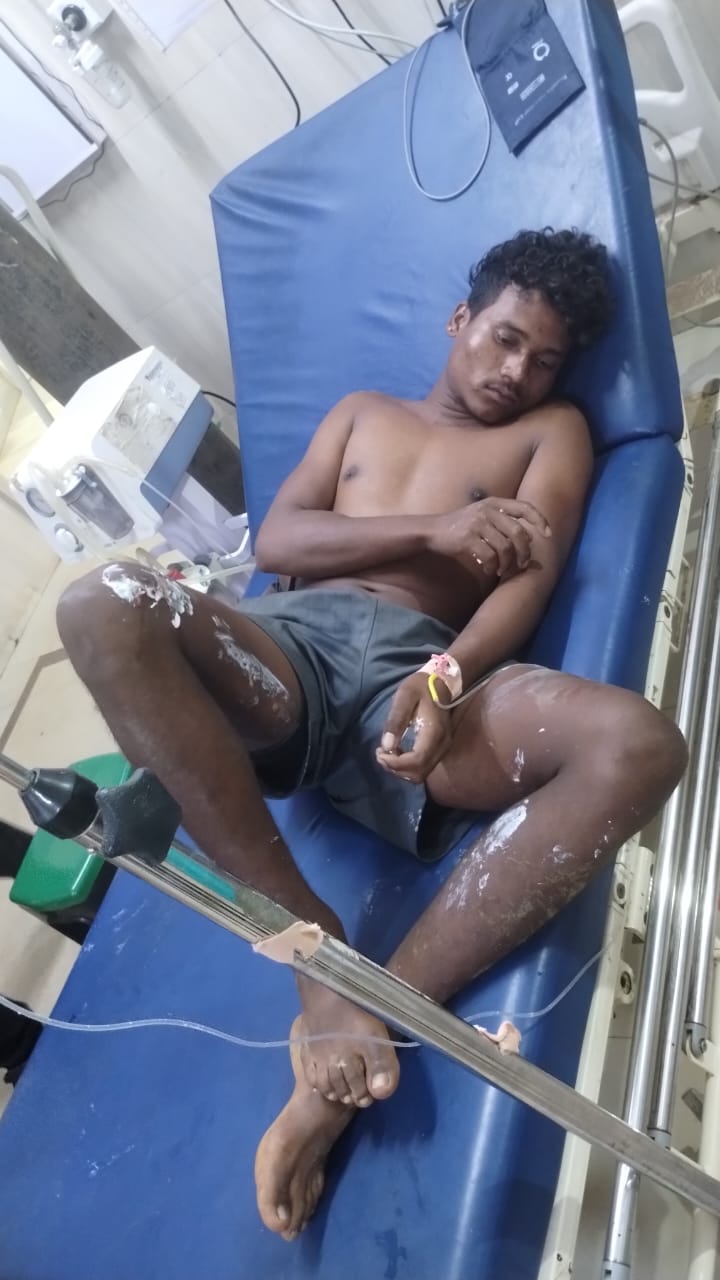 ब्रेकिंग जशपुर जंक्शन:बिजली करंट लगने से दो मजदूर झुलसे, जिला अस्पताल में भर्ती,मीडिया को देख भाग खड़े हुए बिजली विभाग के अधिकारी और ठेकेदार